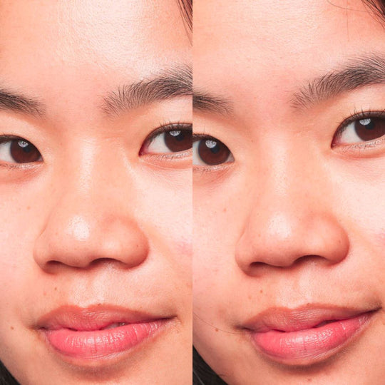 Split image showing the nose and mouth area of a person. The left side shows skin with visible pores, while the right side shows the same area with pores appearing less visible. This apparently after using CAUDALIE Instant Detox Mask