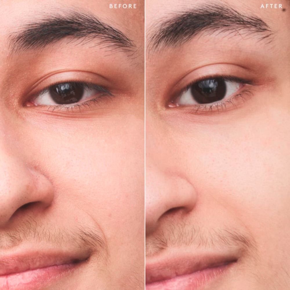 A diptych image shows a "BEFORE" and "AFTER" comparison of a person's eye and cheek area. On the left, the "BEFORE" side shows visible fine lines around the outer corner of the eye and on the cheek, as well as more noticeable pores. On the right, the "AFTER" side shows the same area with visibly smoother skin, reduced appearance of fine lines, and less prominent pores, suggesting an improvement in skin texture.