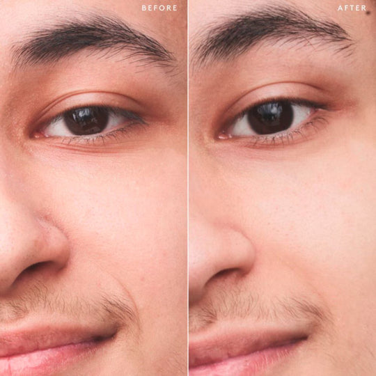 A diptych image shows a "BEFORE" and "AFTER" comparison of a person's eye and cheek area. On the left, the "BEFORE" side shows visible fine lines around the outer corner of the eye and on the cheek, as well as more noticeable pores. On the right, the "AFTER" side shows the same area with visibly smoother skin, reduced appearance of fine lines, and less prominent pores, suggesting an improvement in skin texture.