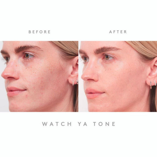 A side-by-side "BEFORE" and "AFTER" image shows a person's face from the nose to the ear. In the "BEFORE" image on the left, the person has visible freckles or dark spots on their cheek and under their eye. In the "AFTER" image on the right, the person's skin appears smoother and more even-toned, with the freckles or dark spots significantly diminished. The text "WATCH YA TONE" is centered below the images.