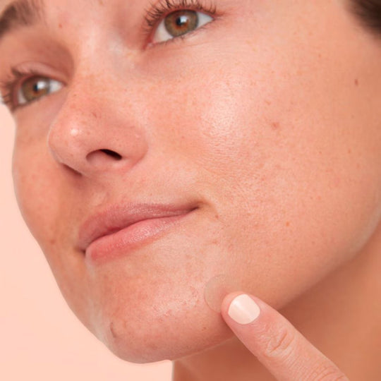 A lady using PEACE OUT SKINCARE Acne Dots - Acne Healing Dots on her face