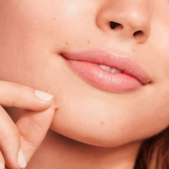 A lady using PEACE OUT SKINCARE Acne Dots - Acne Healing Dots on her face